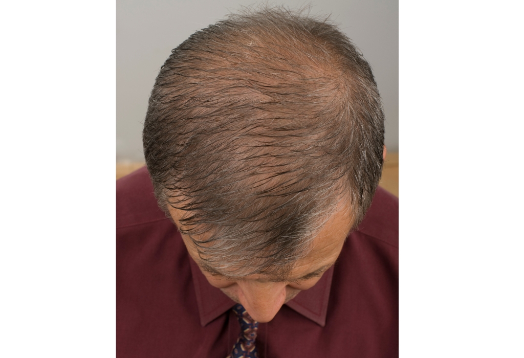 梳头——男人的发型